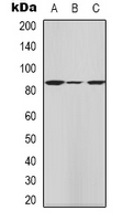HRS / HGS Antibody - Western blot analysis of HGS expression in HeLa (A); mouse kidney (B); mouse testis (C) whole cell lysates.