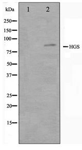 HRS / HGS Antibody - Western blot of HepG2 cell lysate using HGS Antibody