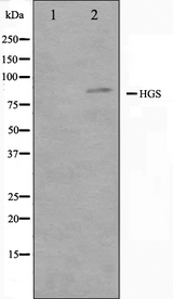 HRS / HGS Antibody - Western blot analysis on HepG2 cell lysates using HGS antibody. The lane on the left is treated with the antigen-specific peptide.