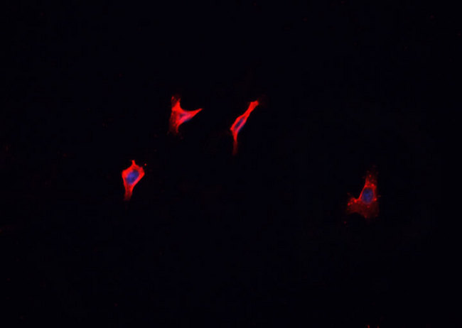 HRS / HGS Antibody - Staining MCF-7 cells by IF/ICC. The samples were fixed with PFA and permeabilized in 0.1% Triton X-100, then blocked in 10% serum for 45 min at 25°C. The primary antibody was diluted at 1:200 and incubated with the sample for 1 hour at 37°C. An Alexa Fluor 594 conjugated goat anti-rabbit IgG (H+L) antibody, diluted at 1/600, was used as secondary antibody.