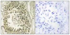 HRS / HGS Antibody - Peptide - + Immunohistochemistry analysis of paraffin-embedded human testis tissue using HGS antibody.