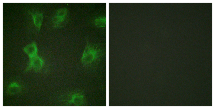 HRS / HGS Antibody - Immunofluorescence analysis of HeLa cells treated with Forskolin 40nM 15', using HRS (Phospho-Tyr334) Antibody. The picture on the right is blocked with the phospho peptide.