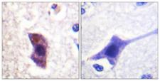 HRS / HGS Antibody - Immunohistochemistry analysis of paraffin-embedded human brain, using HRS (Phospho-Tyr334) Antibody. The picture on the right is blocked with the phospho peptide.