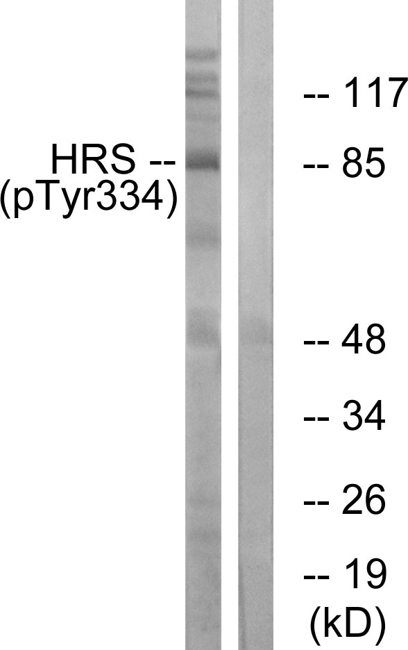 HRS / HGS Antibody - Western blot analysis of lysates from HepG2 cells treated with PMA 125ng/ml 30', using HRS (Phospho-Tyr334) Antibody. The lane on the right is blocked with the phospho peptide.