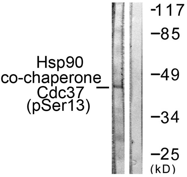 HRS / HGS Antibody - Western blot analysis of extracts from NIH/3T3 cells, using CDC37 (Phospho-Ser13) antibody.