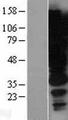HRS / HGS Protein - Western validation with an anti-DDK antibody * L: Control HEK293 lysate R: Over-expression lysate