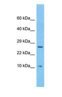 HRSP12 / UK114 Antibody - Western blot of UK114 Antibody with human Lymph node tumor lysate.  This image was taken for the unconjugated form of this product. Other forms have not been tested.