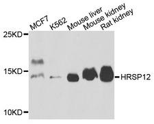 HRSP12 / UK114 Antibody - Western blot analysis of extracts of various cells.