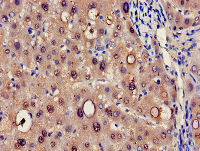 HRSP12 / UK114 Antibody - Immunohistochemistry of paraffin-embedded human liver tissue using HRSP12 Antibody at dilution of 1:100