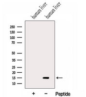 HRSP12 / UK114 Antibody - Western blot analysis of extracts of human liver tissue using HRSP12 antibody. The lane on the left was treated with blocking peptide.