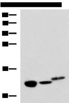 HRSP12 / UK114 Antibody - Western blot analysis of Rat kidney tissue Mouse liver tissue and Human fetal liver tissue lysates  using RIDA Polyclonal Antibody at dilution of 1:600