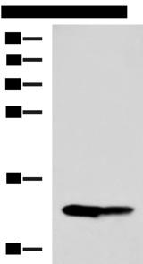 HRSP12 / UK114 Antibody - Western blot analysis of Mouse liver tissue and Mouse kidney tissue lysates  using RIDA Polyclonal Antibody at dilution of 1:650