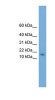 HRSP12 / UK114 Antibody - HRSP12 antibody Western blot of Jurkat lysate. This image was taken for the unconjugated form of this product. Other forms have not been tested.