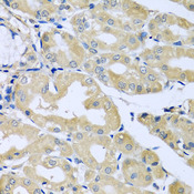 HS1BP3 Antibody - Immunohistochemistry of paraffin-embedded human stomach tissue.