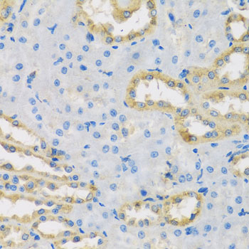 HS1BP3 Antibody - Immunohistochemistry of paraffin-embedded rat kidney tissue.