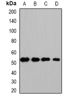 HS1BP3 Antibody - Western blot analysis of HS1BP3 expression in HepG2 (A); mouse kidney (B); mouse heart (C); rat liver (D) whole cell lysates.
