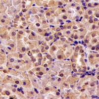 HS1BP3 Antibody - Immunohistochemical analysis of HS1BP3 staining in rat kidney formalin fixed paraffin embedded tissue section. The section was pre-treated using heat mediated antigen retrieval with sodium citrate buffer (pH 6.0). The section was then incubated with the antibody at room temperature and detected using an HRP conjugated compact polymer system. DAB was used as the chromogen. The section was then counterstained with hematoxylin and mounted with DPX.