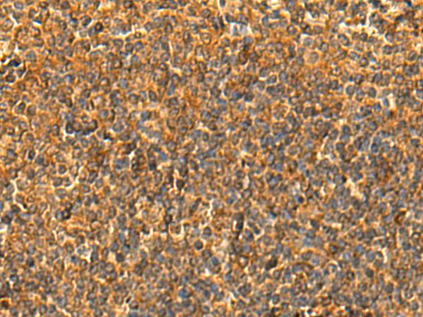 HS1BP3 Antibody - Immunohistochemistry of paraffin-embedded Human tonsil tissue  using HS1BP3 Polyclonal Antibody at dilution of 1:50(×200)