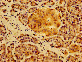 HS2ST1 Antibody - Immunohistochemistry of paraffin-embedded human pancreatic tissue using HS2ST1 Antibody at dilution of 1:100