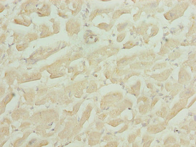 HS3ST1 Antibody - Immunohistochemistry of paraffin-embedded human heart tissue using HS3ST1 Antibody at dilution of 1:100