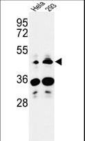 HS3ST2 Antibody - Western blot of HS3ST2 Antibody in HeLa, 293 cell line lysates (35 ug/lane). HS3ST2 (arrow) was detected using the purified antibody.