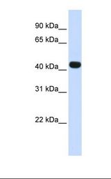 HS3ST3B1 Antibody - Fetal muscle lysate. Antibody concentration: 1.0 ug/ml. Gel concentration: 12%.  This image was taken for the unconjugated form of this product. Other forms have not been tested.
