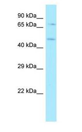 HS6ST1 Antibody - HS6ST1 antibody Western Blot of MCF7.  This image was taken for the unconjugated form of this product. Other forms have not been tested.