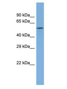 HS6ST2 Antibody - HS6ST2 antibody Western Blot of PANC1. Antibody dilution: 1 ug/ml.  This image was taken for the unconjugated form of this product. Other forms have not been tested.