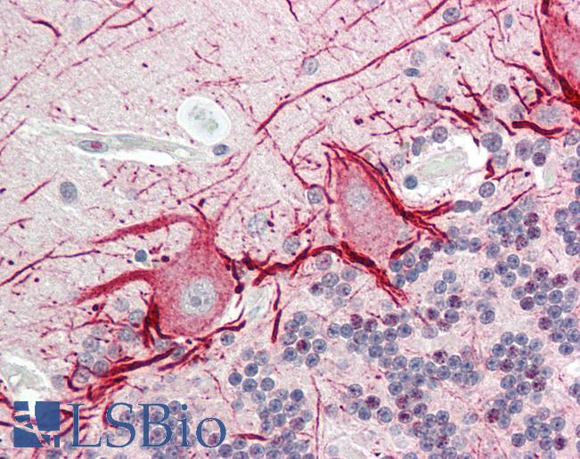 HS6ST3 Antibody - Human Brain, Cerebellum: Formalin-Fixed, Paraffin-Embedded (FFPE).  This image was taken for the unconjugated form of this product. Other forms have not been tested.
