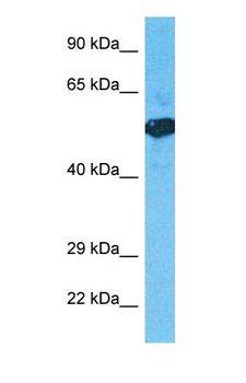 HS6ST3 Antibody - Western blot of H6ST3 Antibody with human Fetal Lung lysate.  This image was taken for the unconjugated form of this product. Other forms have not been tested.