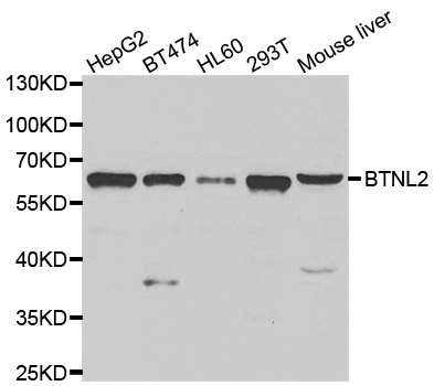 HSBLMHC1 / BTNL2 Antibody - Western blot analysis of extracts of various cell lines.