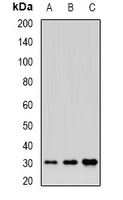 HSBLMHC1 / BTNL2 Antibody - Western blot analysis of BTNL2 expression in HepG2 (A); HL60 (B); mouse liver (C) whole cell lysates.