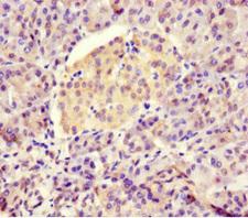 HSBLMHC1 / BTNL2 Antibody - Immunohistochemistry of paraffin-embedded human pancreatic tissue at dilution 1:100