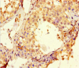 HSBLMHC1 / BTNL2 Antibody - Immunohistochemistry of paraffin-embedded human testis tissue at dilution 1:100