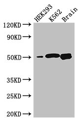 HSBLMHC1 / BTNL2 Antibody - Western Blot Positive WB detected in:HEK293 whole cell lysate,K562 whole cell lysate,Mouse brain tissue All Lanes: BTNL2 antibody at 3.2ug/ml Secondary Goat polyclonal to rabbit IgG at 1/50000 dilution Predicted band size: 51,44,31,28,20,29 kDa Observed band size: 51 kDa