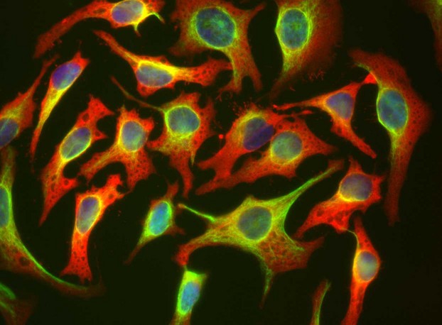 HSBP1 Antibody - HeLa cells staining with HSBP1 antibody (red), and counterstained with chicken polyclonal antibody to Vimentin (green) and DNA (blue). The HSBP1 antibody antibody reveals strong cytoplasmic staining and penetrates into the actin rich ruffled margins, while the Vimentin antibody reveals cytoplasmic intermediate filaments.