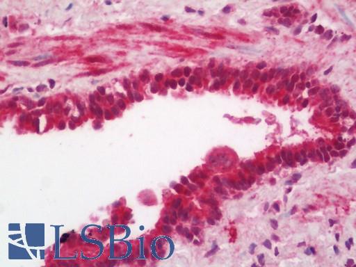 HSBP1 Antibody - Human Lung: Formalin-Fixed, Paraffin-Embedded (FFPE).  This image was taken for the unconjugated form of this product. Other forms have not been tested.