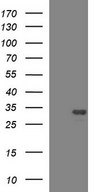 HSCB Antibody - HEK293T cells were transfected with the pCMV6-ENTRY control (Left lane) or pCMV6-ENTRY HSCB (Right lane) cDNA for 48 hrs and lysed. Equivalent amounts of cell lysates (5 ug per lane) were separated by SDS-PAGE and immunoblotted with anti-HSCB.
