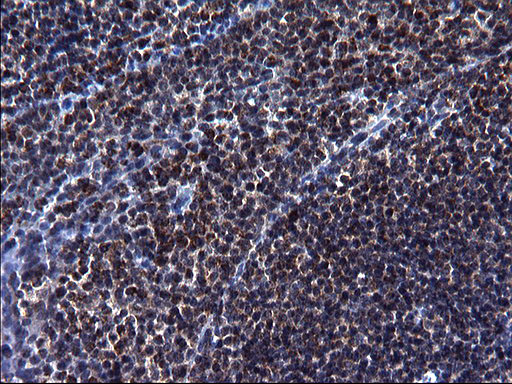 HSCB Antibody - IHC of paraffin-embedded Human lymph node tissue using anti-HSCB mouse monoclonal antibody. (Heat-induced epitope retrieval by 1 mM EDTA in 10mM Tris, pH8.5, 120°C for 3min).