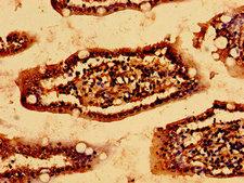HSCB Antibody - Immunohistochemistry image of paraffin-embedded human small intestine tissue at a dilution of 1:100