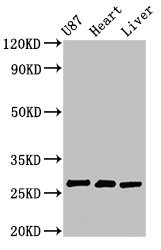 HSCB Antibody - Positive Western Blot detected in U87 whole cell lysate, Rat heart tissue, Rat liver tissue. All lanes: HSCB antibody at 2.7 µg/ml Secondary Goat polyclonal to rabbit IgG at 1/50000 dilution. Predicted band size: 28 KDa. Observed band size: 28 KDa