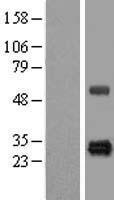HSCB Protein - Western validation with an anti-DDK antibody * L: Control HEK293 lysate R: Over-expression lysate
