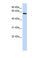 HSD-1 / SPAG8 Antibody - SPAG8 antibody Western blot of HeLa lysate. This image was taken for the unconjugated form of this product. Other forms have not been tested.