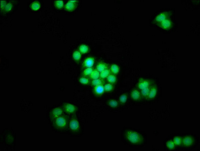 HSD-1 / SPAG8 Antibody - Immunofluorescence staining of PC3 cells at a dilution of 1:133, counter-stained with DAPI. The cells were fixed in 4% formaldehyde, permeabilized using 0.2% Triton X-100 and blocked in 10% normal Goat Serum. The cells were then incubated with the antibody overnight at 4 °C.The secondary antibody was Alexa Fluor 488-congugated AffiniPure Goat Anti-Rabbit IgG (H+L) .