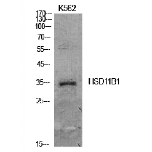 HSD11B1 / HSD11B Antibody - Western blot of 11beta-HSD1 antibody