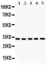 HSD11B1 / HSD11B Antibody - HSD11B1 antibody Western blot. All lanes: All lanes: Anti HSD11B1 at 0.5 ug/ml. Lane 1: Rat Liver Tissue Lysate at 50 ug. Lane 2: Rat Testis Tissue Lysate at 50 ug. Lane 3: SMMC Whole Cell Lysate at 40 ug. Lane 4: RAJI Whole Cell Lysate at 40 ug. Lane 5: SW620 Whole Cell Lysate at 40 ug. Predicted band size: 32 kD. Observed band size: 32 kD.