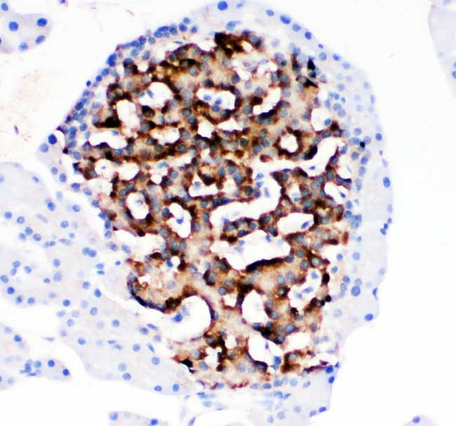 HSD11B1 / HSD11B Antibody - IHC analysis of HSD11B1 using anti-HSD11B1 antibody. HSD11B1 was detected in paraffin-embedded section of rat pancreas tissues. Heat mediated antigen retrieval was performed in citrate buffer (pH6, epitope retrieval solution) for 20 mins. The tissue section was blocked with 10% goat serum. The tissue section was then incubated with 1µg/ml rabbit anti-HSD11B1 Antibody overnight at 4°C. Biotinylated goat anti-rabbit IgG was used as secondary antibody and incubated for 30 minutes at 37°C. The tissue section was developed using Strepavidin-Biotin-Complex (SABC) with DAB as the chromogen.