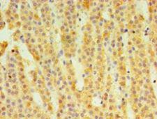 HSD11B1 / HSD11B Antibody - Immunohistochemistry of paraffin-embedded human adrenal gland using antibody at 1:100 dilution.  This image was taken for the unconjugated form of this product. Other forms have not been tested.