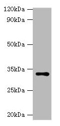 HSD11B1 / HSD11B Antibody - Western blot All lanes: Corticosteroid 11-beta-dehydrogenase isozyme 1 antibody at 2µg/ml + Hela cells Secondary Goat polyclonal to rabbit IgG at 1/10000 dilution Predicted band size: 32 kDa Observed band size: 32 kDa