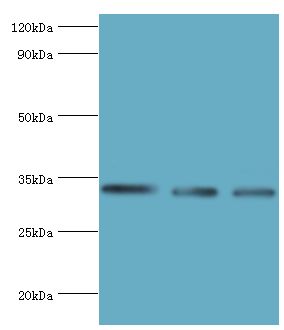 HSD11B1 / HSD11B Antibody - Western blot. All lanes: Corticosteroid 11-beta-dehydrogenase isozyme 1 antibody at 7 ug/ml. Lane 1: mouse liver tissue. Lane 2: Jurkat whole cell lysate. Lane 2: LO2 whole cell lysate. Secondary antibody: Goat polyclonal to rabbit at 1:10000 dilution. Predicted band size: 32 kDa. Observed band size: 32 kDa.